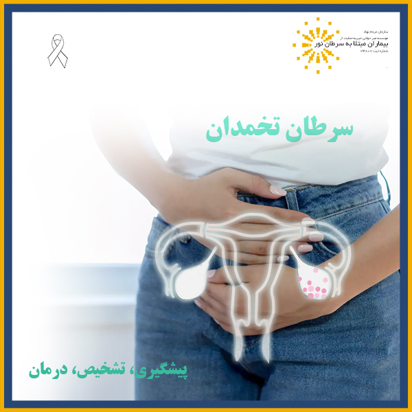سرطان تخمدان
